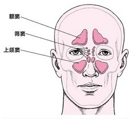 鼻窦炎一般需要做哪些检查，怎么治？